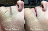Red light therapy before and after images showing impact of anti-aging treatment (mobile version)
