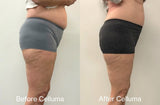 before and after photos showing impact of red light therapy on reducing belly fat (mobile version)
