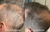 Before and After (top and bottom) showing a the side of a man's head with darker hair and new hair growth on the scalp after LED red light therapy treatments. Results after 12 weeks.