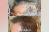 Before and After (top and bottom) showing a the side of a man's head with darker hair and new hair growth on the scalp after LED red light therapy treatments. Results after 12 weeks.