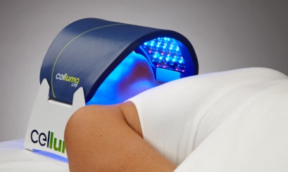 Celluma CLEAR device for treatment of chronic acne