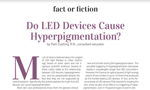 Do LED devices cause hyperpigmentation?