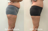 Body contouring before and after images of woman (facing right) from a Celluma study showing reduction in the circumference of hips, waist, and thighs after 4 weeks treatment with red and near-infrared LED light therapy. Results after 4 weeks, treating 3 times per week for 30 minutes. Device used was the Celluma CONTOUR System.