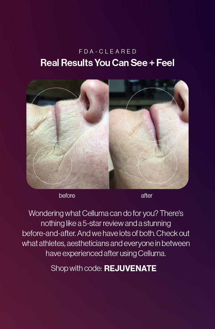 Advertisement for Celluma with 'before' and 'after' images of a person's neck, text about real results, and a call to action to shop with code REJUVENATE for up to $300 in savings.
