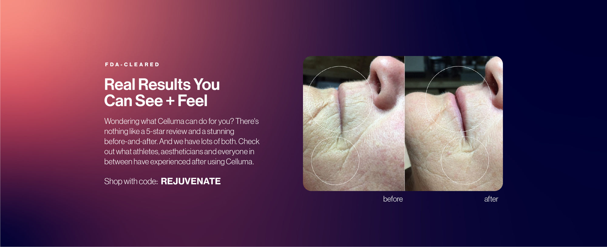 Advertisement for Celluma with 'before' and 'after' images of a person's neck, text about real results, and a call to action to shop with code REJUVENATE for up to $300 in savings.