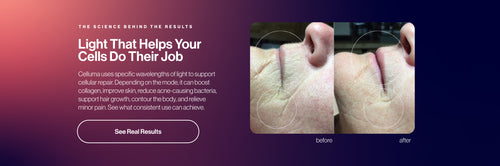 Promotional banner with text about light cells and before/after skin result photos on a purple-to-pink gradient background.
