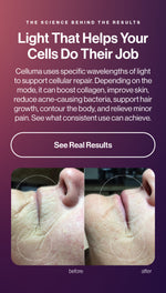 Promotional graphic with text about light therapy and before/after close-up photos of a person's face on a dark purple gradient background.